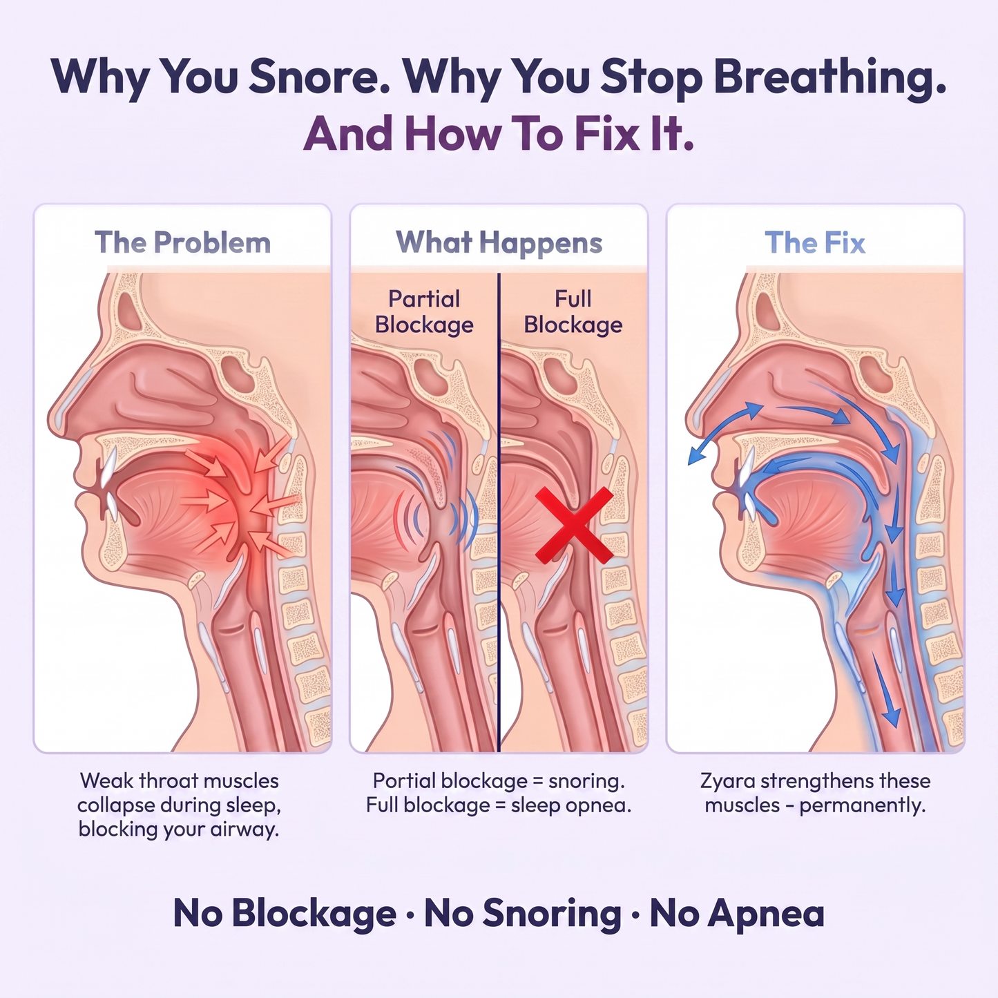 Zyara™ EasySleep Device
